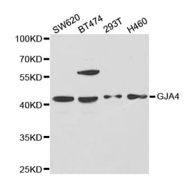 Western blot - GJA4 Antibody from Signalway Antibody (32695) - Antibodies.com