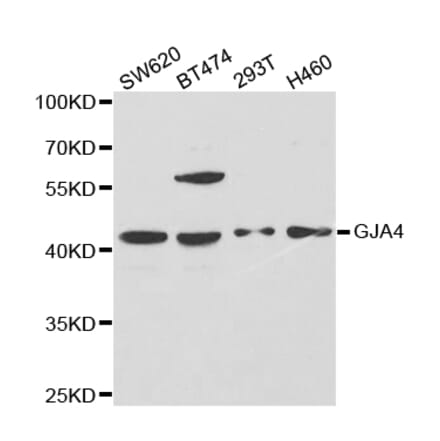 Western blot - GJA4 Antibody from Signalway Antibody (32695) - Antibodies.com