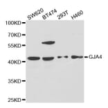 Western blot - GJA4 Antibody from Signalway Antibody (32695) - Antibodies.com