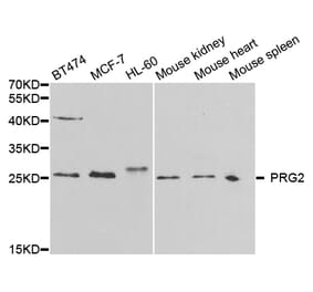 Western blot - PRG2 Antibody from Signalway Antibody (32697) - Antibodies.com