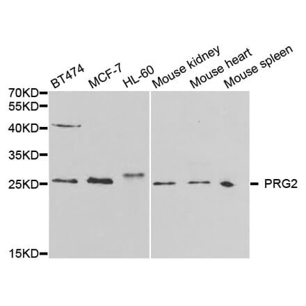 Western blot - PRG2 Antibody from Signalway Antibody (32697) - Antibodies.com