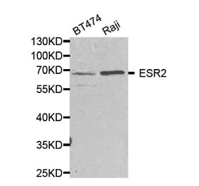 Western blot - ESR2 Antibody from Signalway Antibody (32704) - Antibodies.com