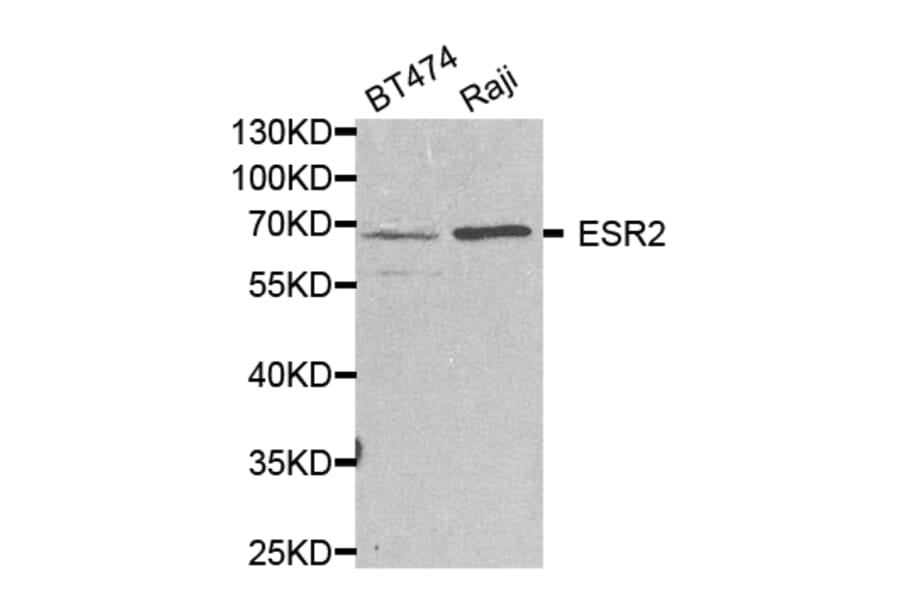 Western blot - ESR2 Antibody from Signalway Antibody (32704) - Antibodies.com