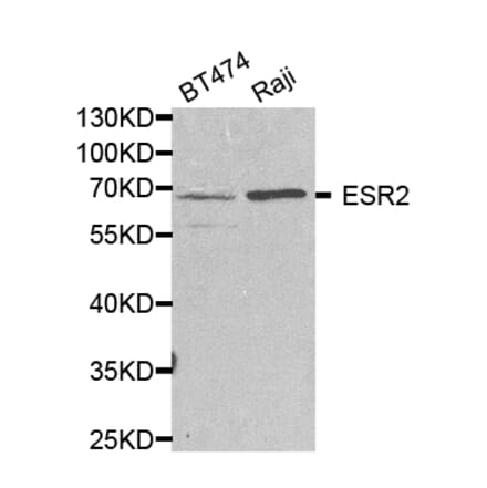 Western blot - ESR2 Antibody from Signalway Antibody (32704) - Antibodies.com