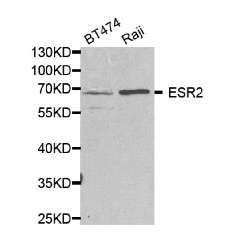 Western blot - ESR2 Antibody from Signalway Antibody (32704) - Antibodies.com