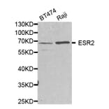 Western blot - ESR2 Antibody from Signalway Antibody (32704) - Antibodies.com