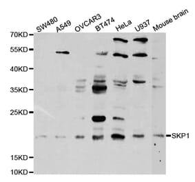 Western blot - SKP1 Antibody from Signalway Antibody (32718) - Antibodies.com