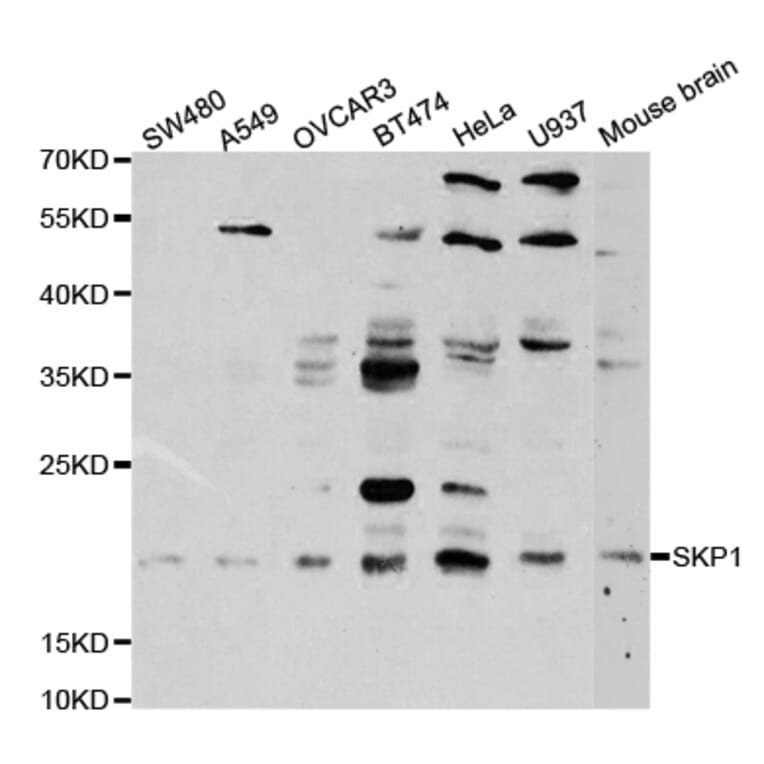 Western blot - SKP1 Antibody from Signalway Antibody (32718) - Antibodies.com