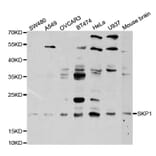 Western blot - SKP1 Antibody from Signalway Antibody (32718) - Antibodies.com