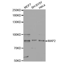 Western blot - MAP2 Antibody from Signalway Antibody (32723) - Antibodies.com