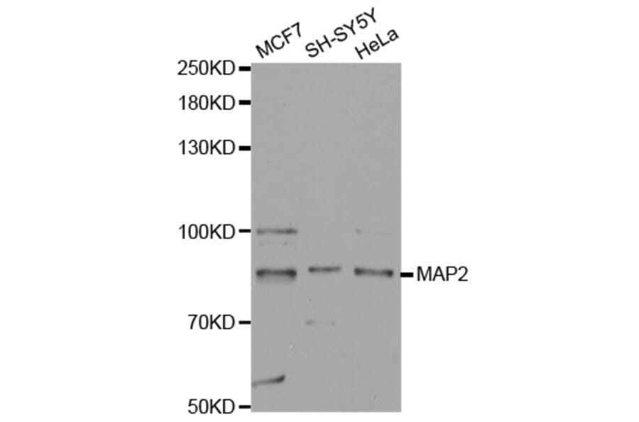 Western blot - MAP2 Antibody from Signalway Antibody (32723) - Antibodies.com