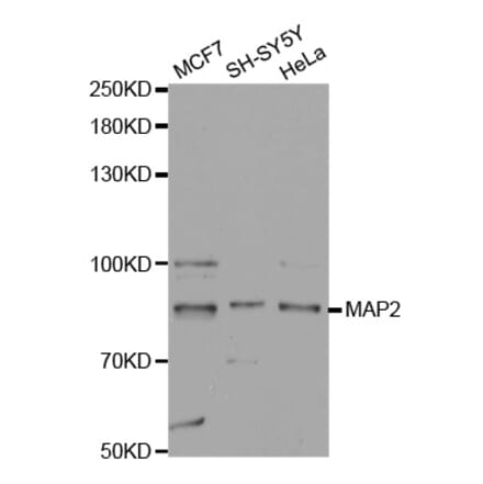 Western blot - MAP2 Antibody from Signalway Antibody (32723) - Antibodies.com