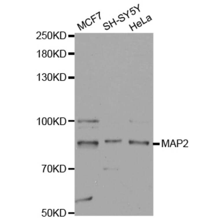 Western blot - MAP2 Antibody from Signalway Antibody (32723) - Antibodies.com