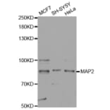 Western blot - MAP2 Antibody from Signalway Antibody (32723) - Antibodies.com
