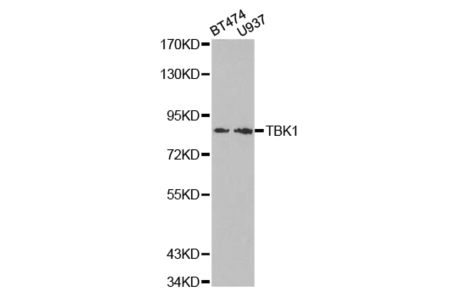 Western blot - TBK1 Antibody from Signalway Antibody (32724) - Antibodies.com