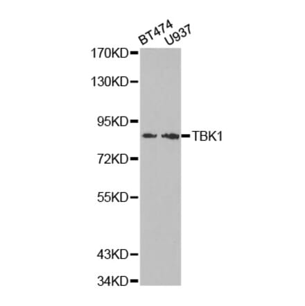 Western blot - TBK1 Antibody from Signalway Antibody (32724) - Antibodies.com