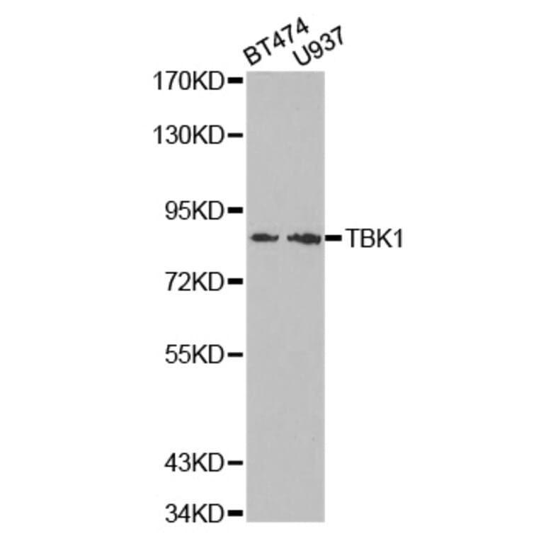 Western blot - TBK1 Antibody from Signalway Antibody (32724) - Antibodies.com