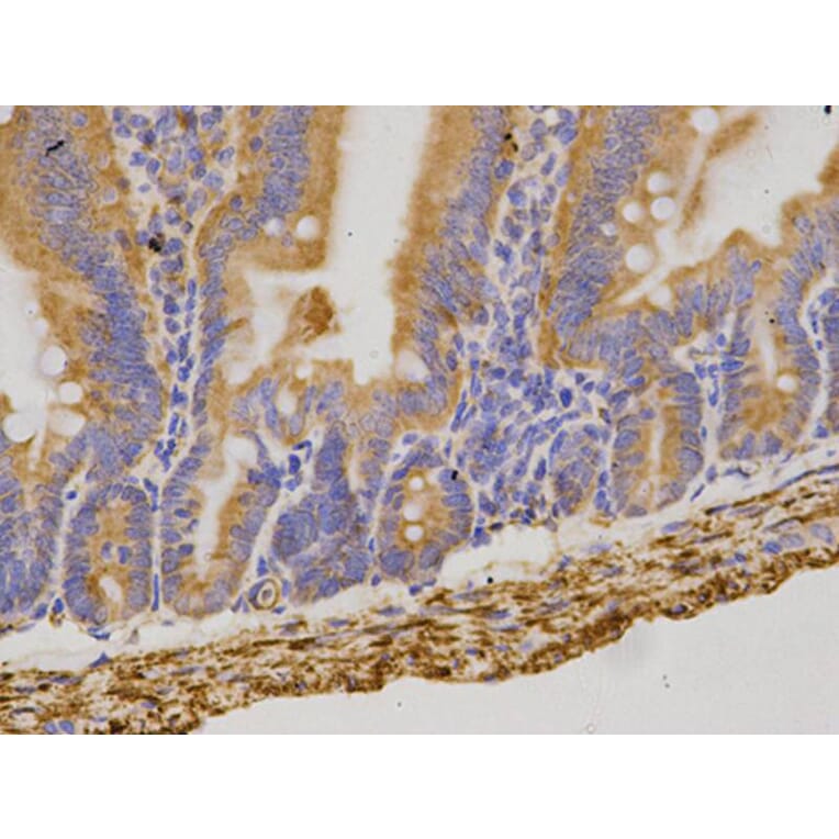 Immunohistochemistry - CD19 Antibody from Signalway Antibody (32727) - Antibodies.com
