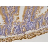 Immunohistochemistry - CD19 Antibody from Signalway Antibody (32727) - Antibodies.com