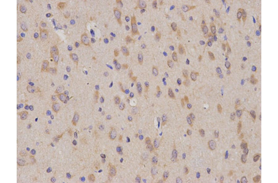 Immunohistochemistry - CD19 Antibody from Signalway Antibody (32727) - Antibodies.com