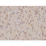 Immunohistochemistry - CD19 Antibody from Signalway Antibody (32727) - Antibodies.com