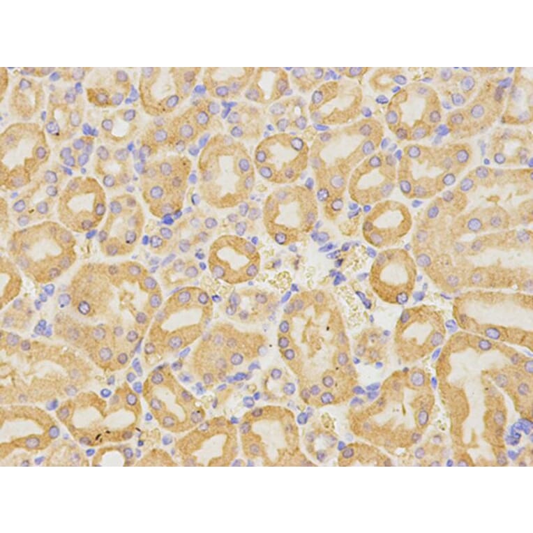 Immunohistochemistry - CD19 Antibody from Signalway Antibody (32727) - Antibodies.com