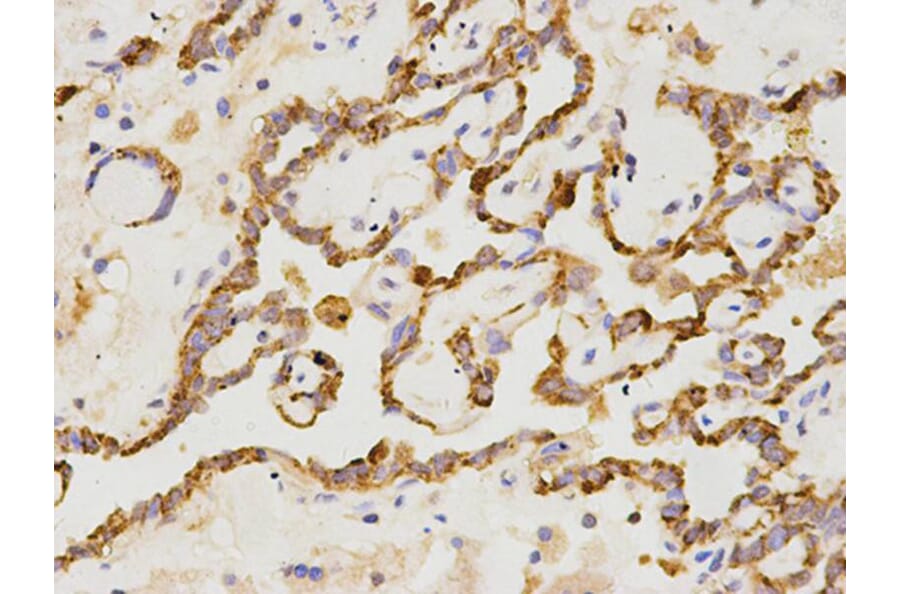 Immunohistochemistry - CD19 Antibody from Signalway Antibody (32727) - Antibodies.com