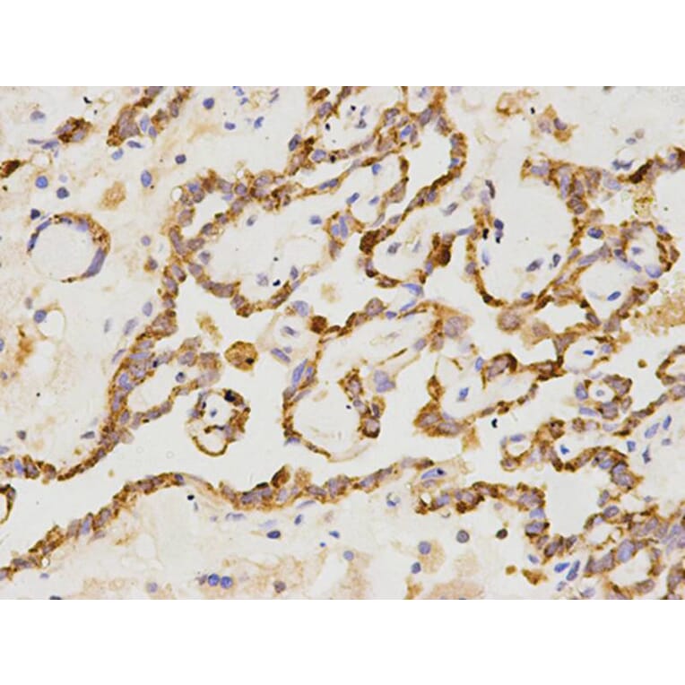 Immunohistochemistry - CD19 Antibody from Signalway Antibody (32727) - Antibodies.com