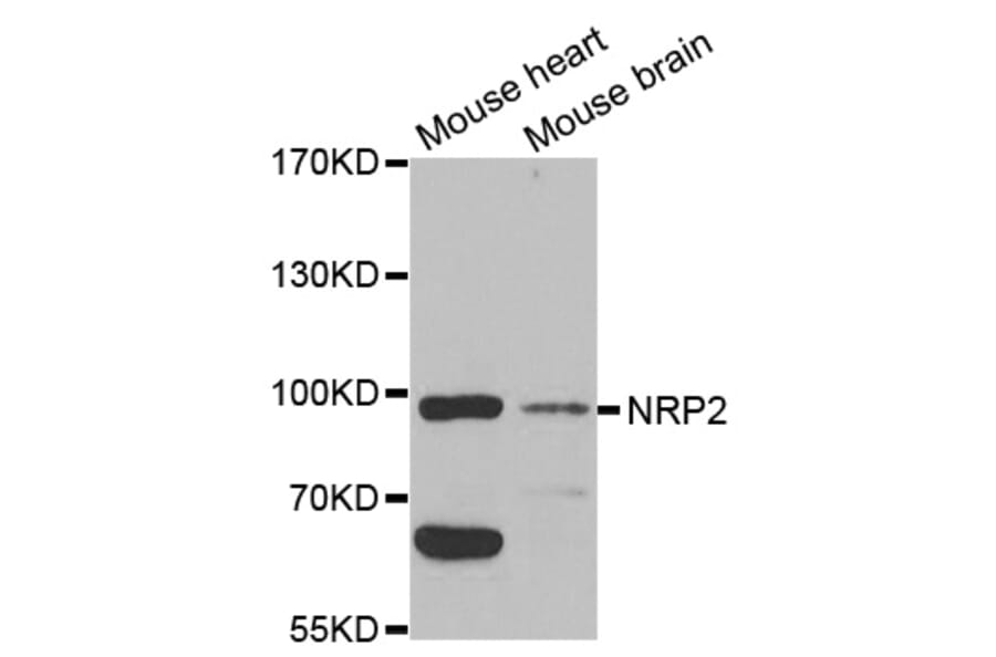 Western blot - NRP2 Antibody from Signalway Antibody (32730) - Antibodies.com