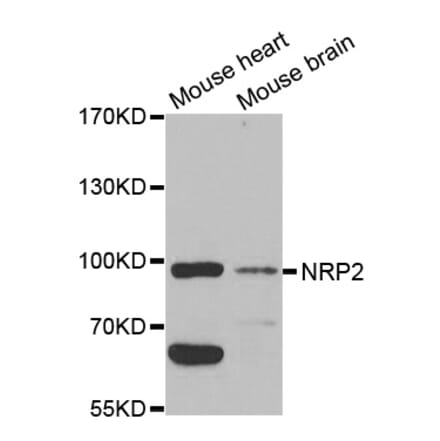 Western blot - NRP2 Antibody from Signalway Antibody (32730) - Antibodies.com
