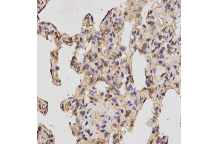 Immunohistochemistry - NRP2 Antibody from Signalway Antibody (32730) - Antibodies.com
