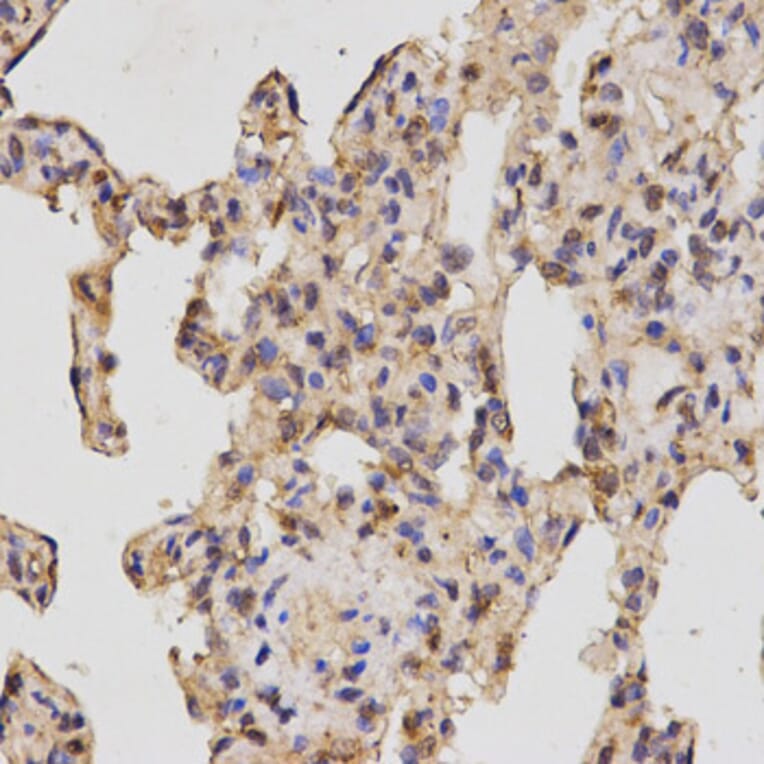 Immunohistochemistry - NRP2 Antibody from Signalway Antibody (32730) - Antibodies.com