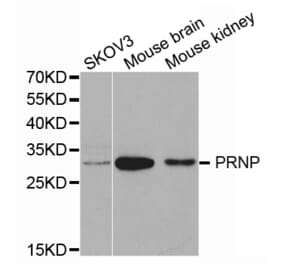Western blot - PRNP Antibody from Signalway Antibody (32732) - Antibodies.com