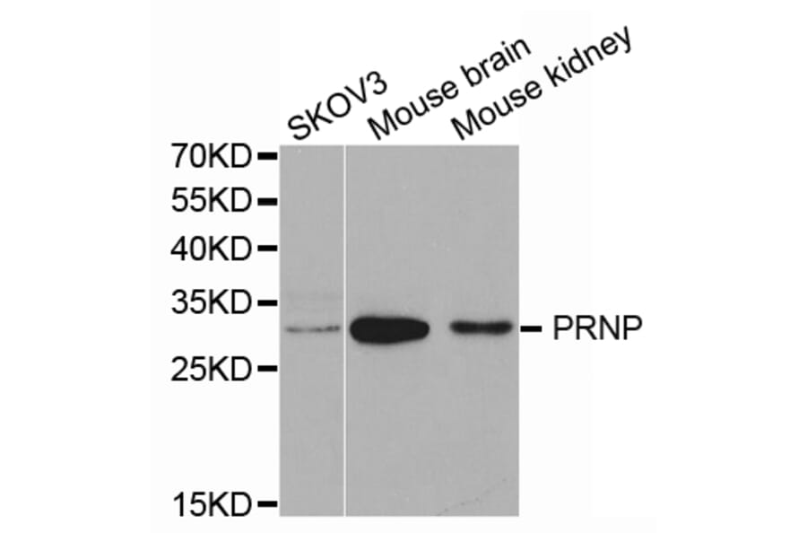 Western blot - PRNP Antibody from Signalway Antibody (32732) - Antibodies.com