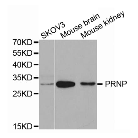 Western blot - PRNP Antibody from Signalway Antibody (32732) - Antibodies.com
