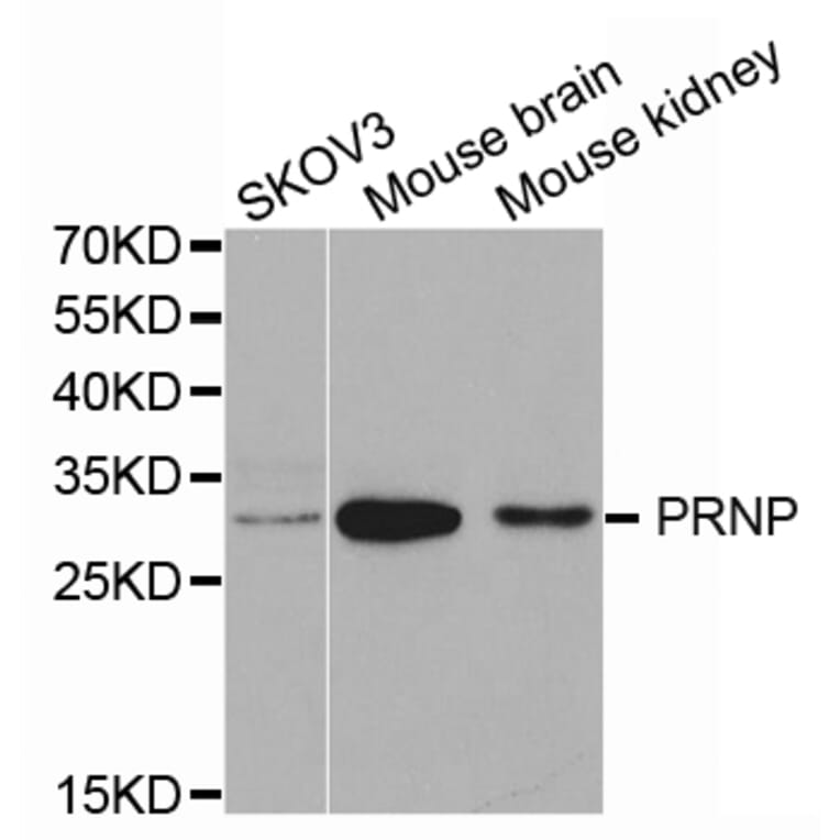 Western blot - PRNP Antibody from Signalway Antibody (32732) - Antibodies.com
