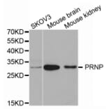 Western blot - PRNP Antibody from Signalway Antibody (32732) - Antibodies.com