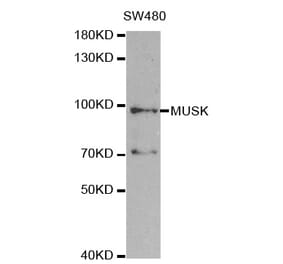 Western blot - MUSK Antibody from Signalway Antibody (32738) - Antibodies.com