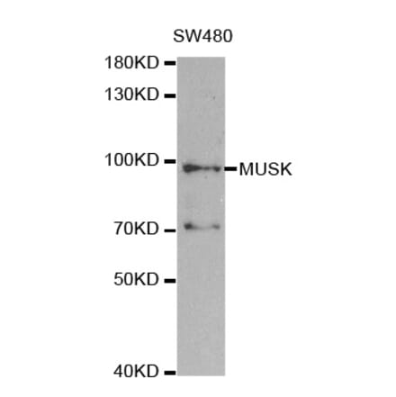 Western blot - MUSK Antibody from Signalway Antibody (32738) - Antibodies.com