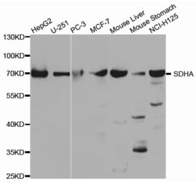 Western blot - SDHA Antibody from Signalway Antibody (32741) - Antibodies.com