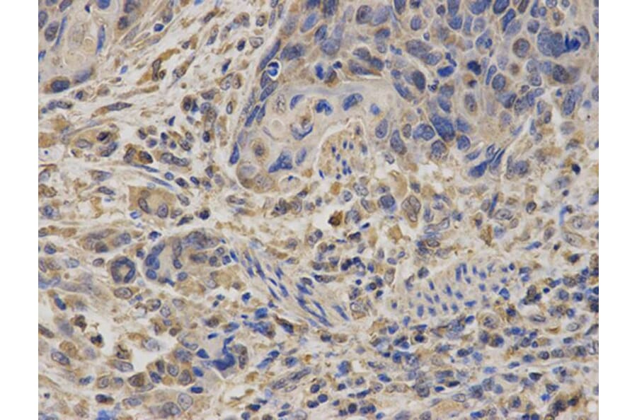 Immunohistochemistry - SDHA Antibody from Signalway Antibody (32741) - Antibodies.com