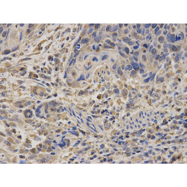 Immunohistochemistry - SDHA Antibody from Signalway Antibody (32741) - Antibodies.com