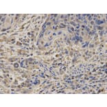 Immunohistochemistry - SDHA Antibody from Signalway Antibody (32741) - Antibodies.com