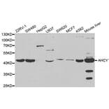 Western blot - AHCY Antibody from Signalway Antibody (32754) - Antibodies.com