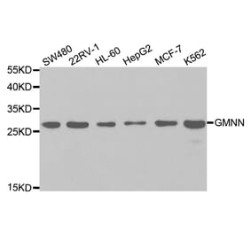 Western blot - GMNN Antibody from Signalway Antibody (32767) - Antibodies.com