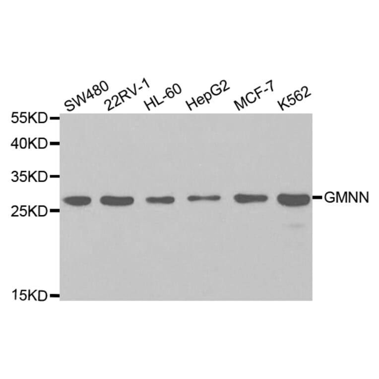 Western blot - GMNN Antibody from Signalway Antibody (32767) - Antibodies.com