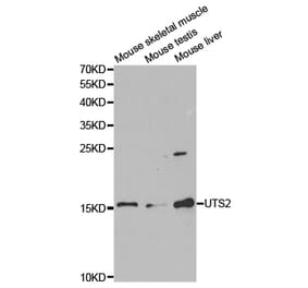 Western blot - UTS2 Antibody from Signalway Antibody (32778) - Antibodies.com