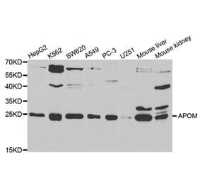 Western blot - APOM Antibody from Signalway Antibody (32780) - Antibodies.com