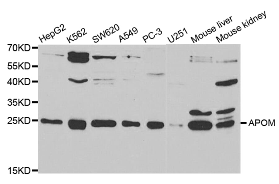 Western blot - APOM Antibody from Signalway Antibody (32780) - Antibodies.com