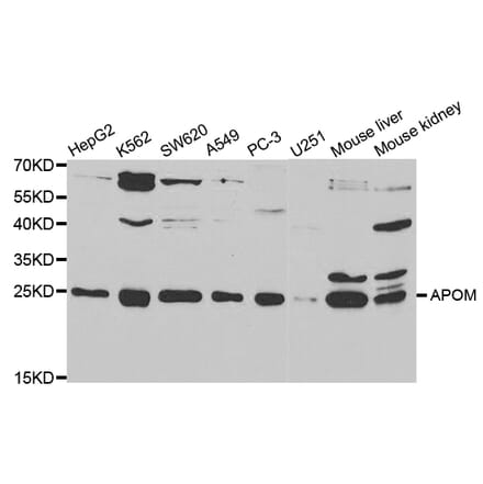 Western blot - APOM Antibody from Signalway Antibody (32780) - Antibodies.com